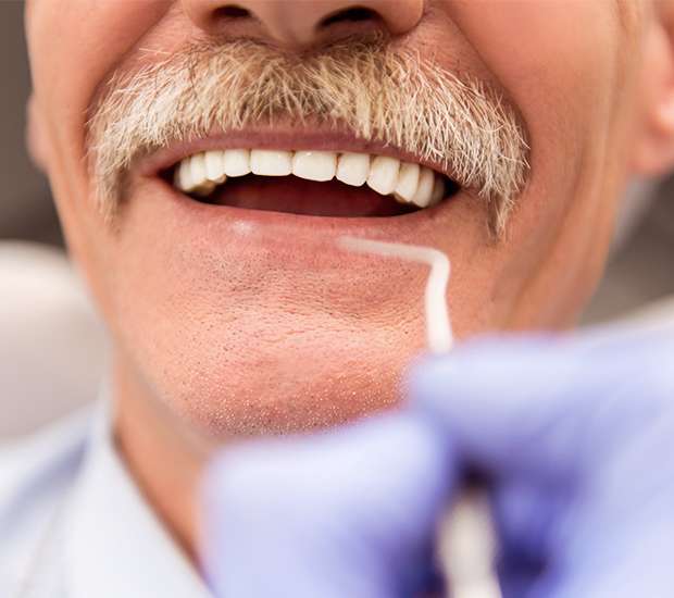 Gilbert Adjusting to New Dentures