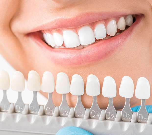 Gilbert Cosmetic Dentist