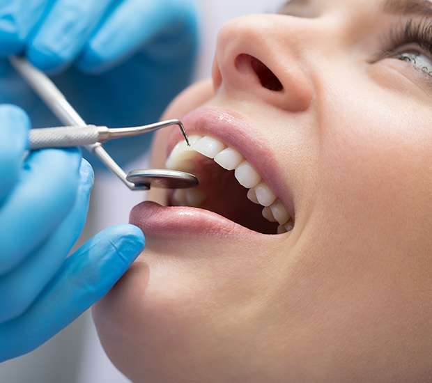 Gilbert Dental Bonding