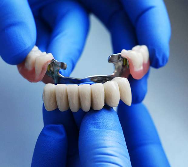 Gilbert Dental Bridges