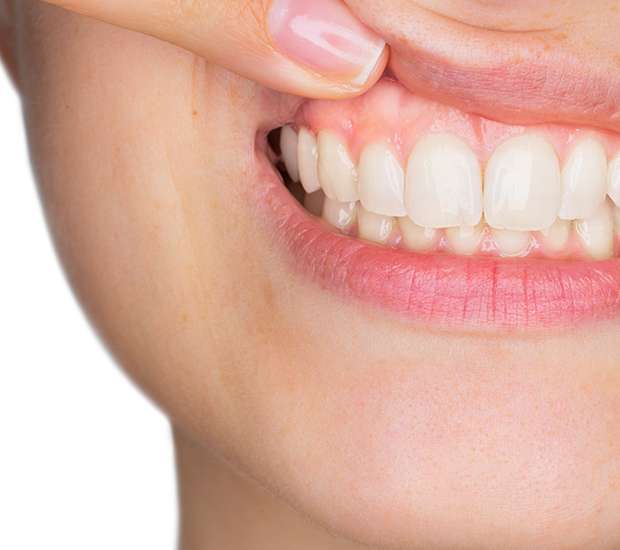Gilbert Gum Disease