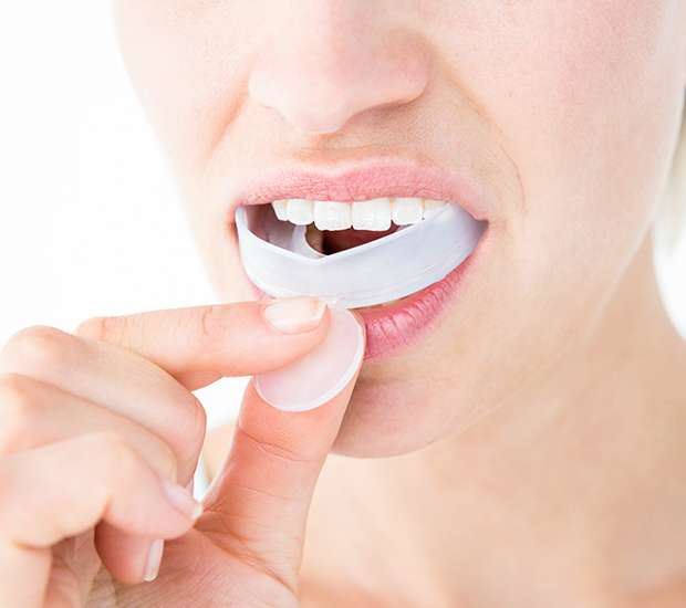 Gilbert Mouth Guards