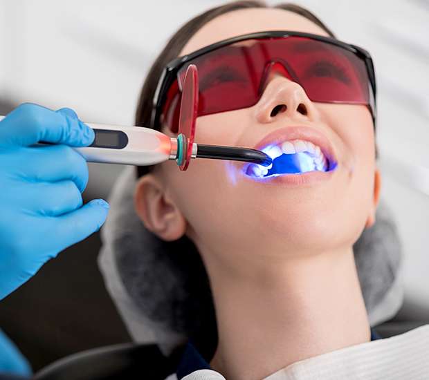 Gilbert Professional Teeth Whitening