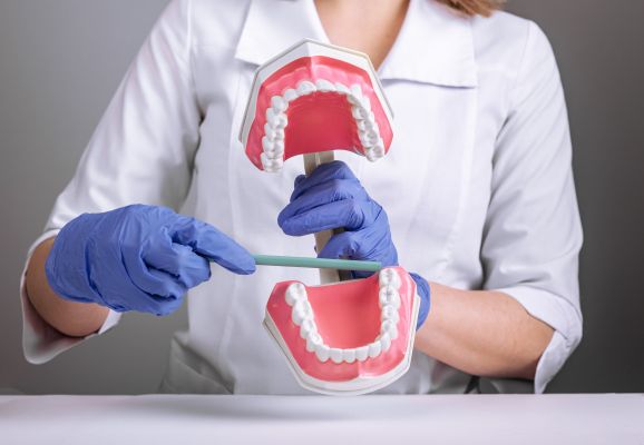 Who Needs A Wisdom Tooth Extraction?